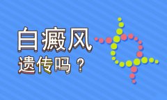 【河北最权威的白癜风医院】白癜风病会遗传给