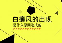 北京白癜风医生发病病因是什么?