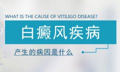 北京白癜风研究院:寻常型白癜风应该与哪些疾病